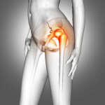 3D female medical figure with hip bone highlighted